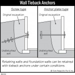 B111 Wall Tieback Anchors 150x150